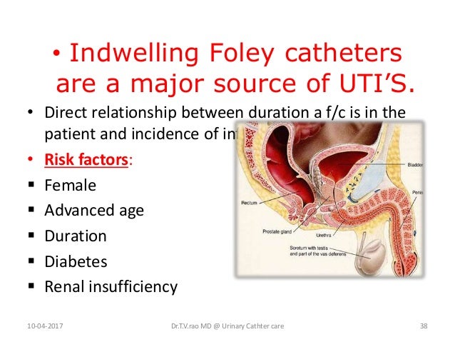 Indwelling Catheter in Home Care